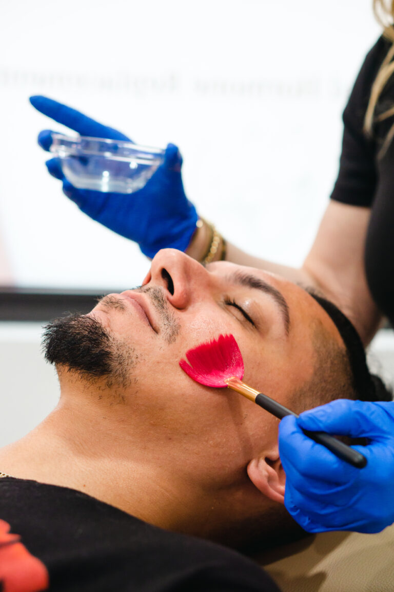 skin peeling treatment davie and broward FL